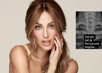 Anahi-sufre-una-aparatosa-caida - Informe Regio Portrait of a woman with brown hair touching her face on the right a grayscale chest X ray with Spanish text overlay about being fine but startled Informe Regio